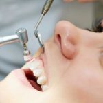 Teeth-Scaling