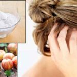 itchy-scalp-treatment