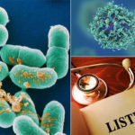 All-you-need-to-know-about-listeria-outbreak2018