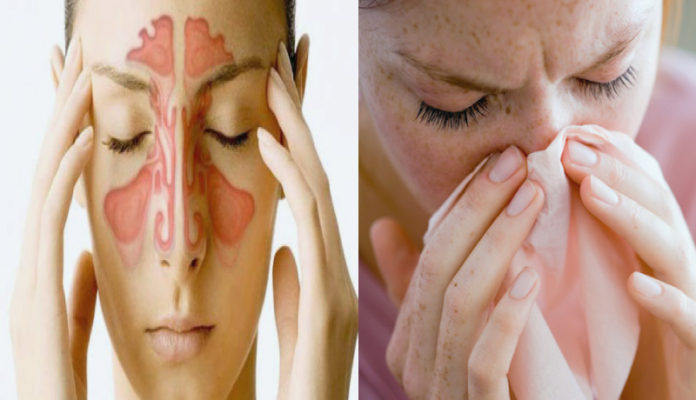 Sinus Infection Home Remedies